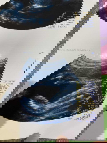 6เดือนแล้วค่ะ #ทีมธันวาคม