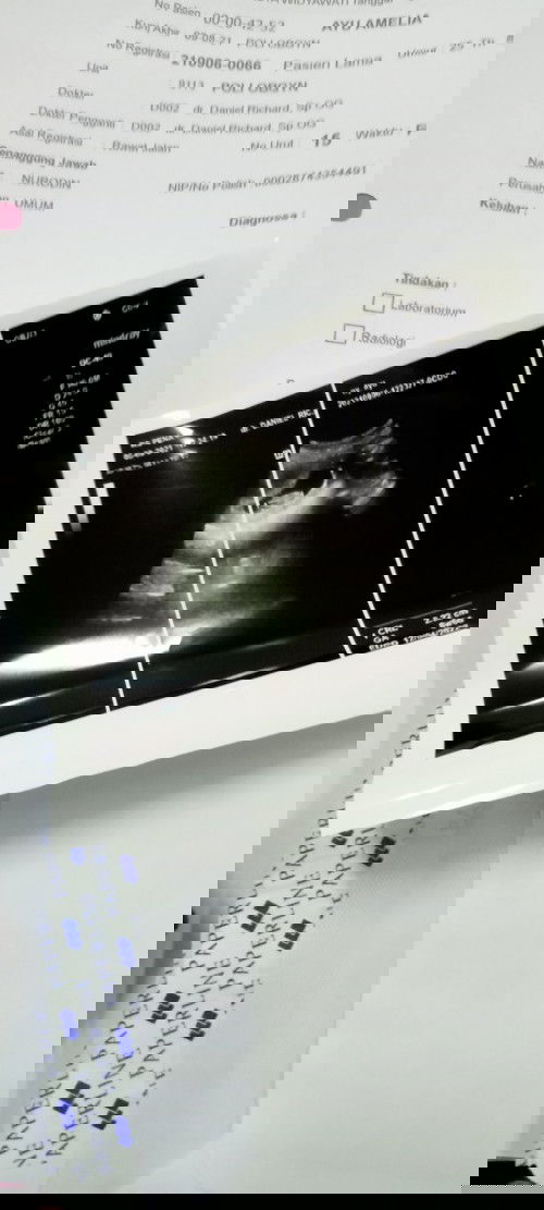 Saya mau bertanya bunda , jarak SC 10bln dan saya sekarang positiv hamil  LG apakah berbahaya