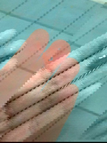 เลือดออกช่องคลอด ปวดท้องน้อย