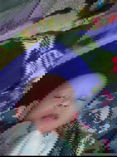 Bayi 21 hari, udah 2 hari bintik bintik merah.. Secara tiba tiba ada yang sama kaya bayi akungga?