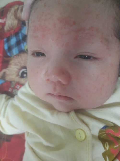 Cac mom cho e hỏi