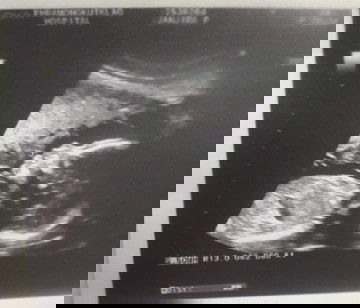 วันนี้น้องกลับมาเกิดใหม่อีกครั้ง