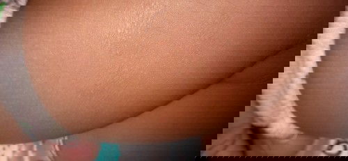 Kaki tiba tiba brintis