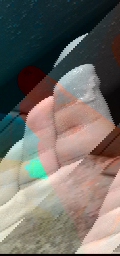 แม่ๆคะมูกแบบนี้ อันตรายไหม