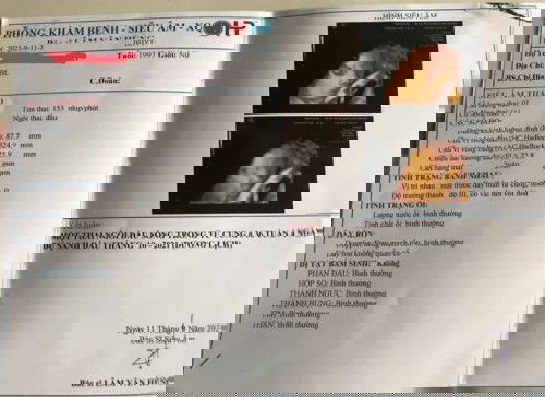 36w4d❤️❤️❤️❤️❤️