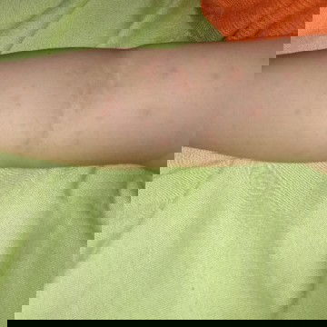 Bintik - bintik merah