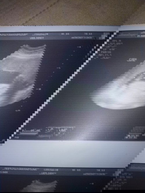 hello po mga mommies
ok lang po ba result nang pelvic ultz ko??