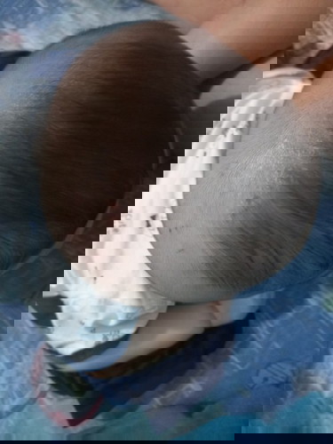 Bé bị như hình là bị nấm đúng k các mom, mom nào biết cách trị tv e với