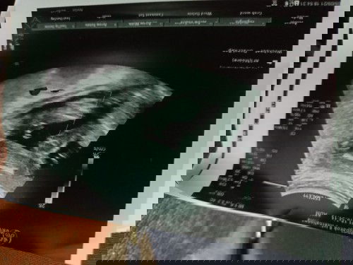 แม่ๆดูออกไหมค่ะว่าผู้หญิงหรือชาย