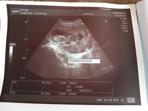 ทีม เดือน กุมภาพันธ์ 65