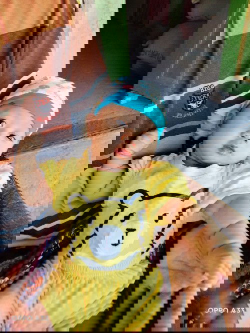 Benjolan di alis sebelah kanan atas