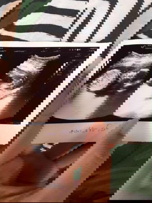 เเม่ท่านไหนดูออก ว่าเพศหญิงหรือชายคะ