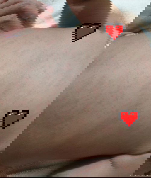 Efek setelah imunisasi campak