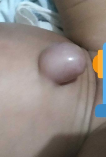 Puser nonjol