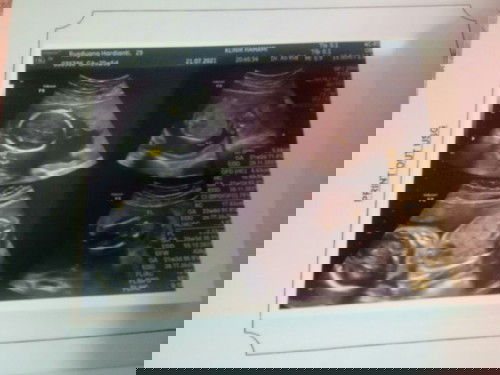 asupan nutrisi yang dimakan untuk menambah berat badan bayi