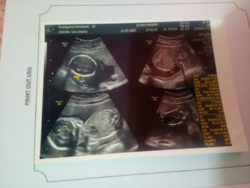 asupan nutrisi yang dimakan untuk menambah berat badan bayi