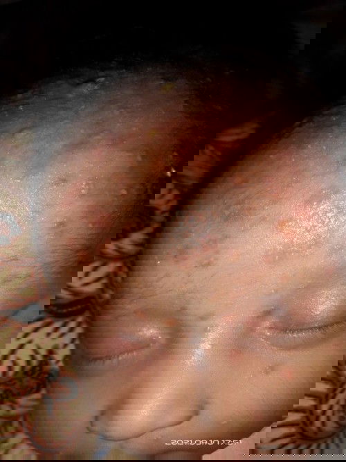 Tanya anak gatal apa gimana