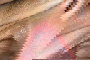 Bun,putih2 dlam mlut bayi knpa ya?,anakku smpai sluruh mlut putih2,tlong share obat dong yg pnglaman