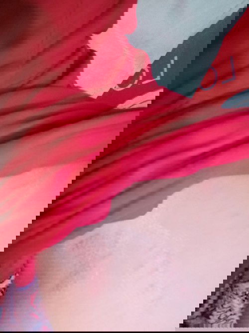 เป็นผื่นแดง ทาคารามายก็ไม่หาย