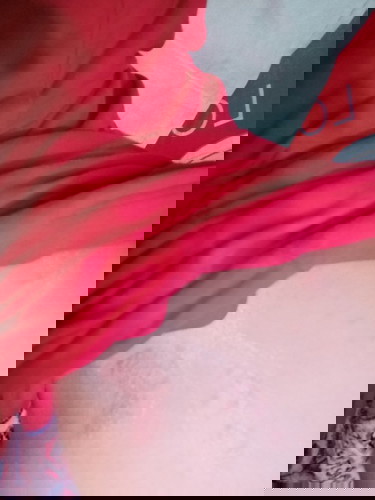 เป็นผื่นแดง ทาคารามายก็ไม่หาย