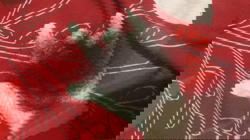 Rambut rontok pasca lahiran