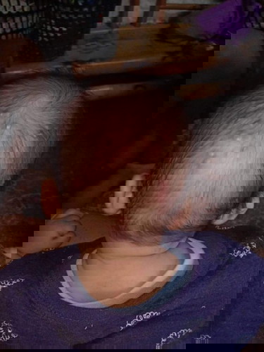 butlig na may nana sa ulo ni baby