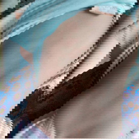 เหงือกบวมฟันขึ้น