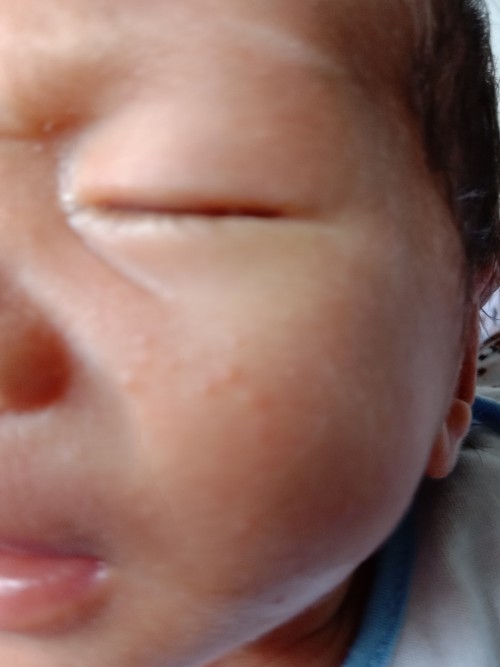 #rômsẩy #xinýkiến