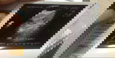 ท้องแรก ควรดูแลตัวเองยังไงบ้างค่ะ