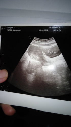 "Tespek 2 garis tapi kata dokter hanya masalah hormonal"