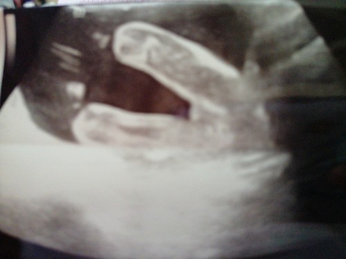 Scan baby
