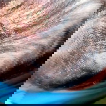 Kerak di kepala bayi