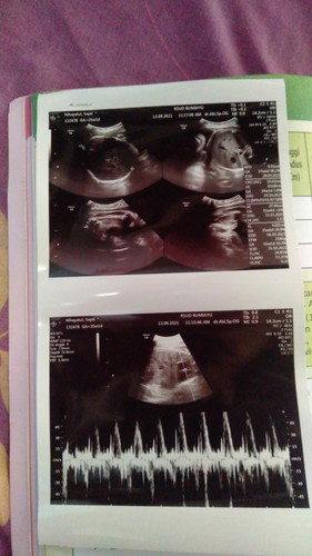 HARGA UMUM ATAU KEMAHALAN