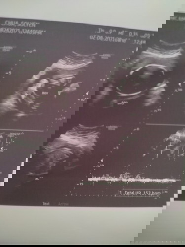 hoping for a baby girl