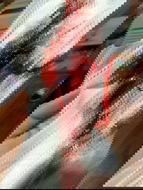 นี่ใช่ประจำเดือนหลังคลอดไหม ทำไมมีลิ้มเลือดออกเยอะจังกังวลมาก