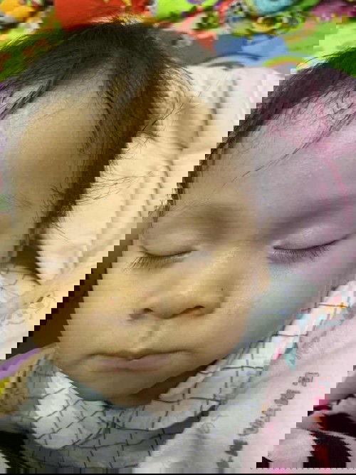 ผื่นขึ้นหน้าน้องแบบนี้เกิดจากอะไรคะ เป็นผดเล็ก ๆ