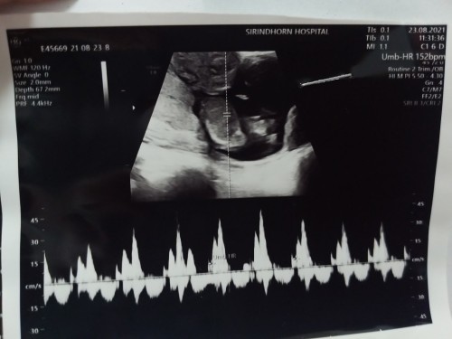 ช่วยดูหน่อยจร้า