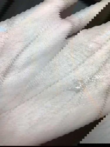 ท้อง 17สัปดาห์ 3วัน