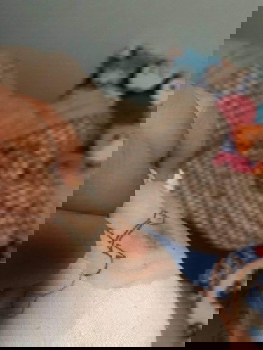 ตั้งครรภ์ 32w มีน่ำนมปนเลือด