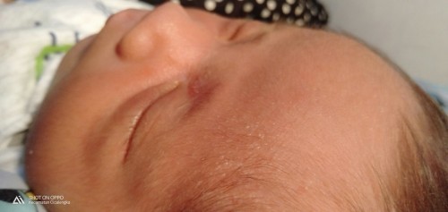 Di dahi dan kepala bayi ada bintik2 seperti air