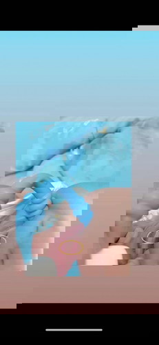 ฟันกำลังจะขึ้น🦷🪥