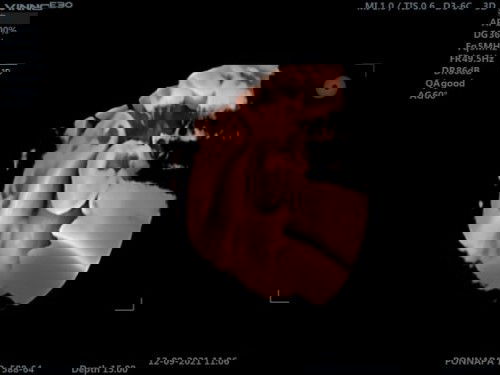 แบบนี้ผู้ชายชั่วใชไมค่ะ แม่ช่วยดูหน่อยนะค่ะ คุนหมอไม่ได้บอก ค่ะชว่ยแม่บ้านนี้ดูหน่อยจ้าาทีมธันวาคม64