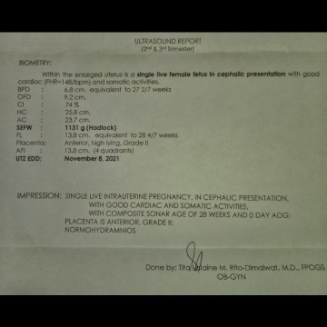 ULTRASOUND AT 28 WEEKS 💖