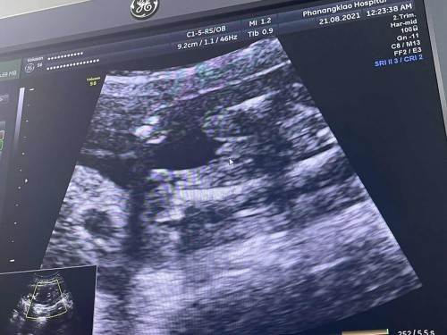 ช่วยดูเพศน้องหน่อยจ้า