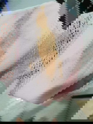 ตอนนี้อายุครรภ์ได้ 8 weekแล้วค่ะ