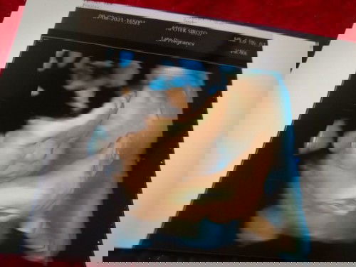 Bun mau nanya bingung