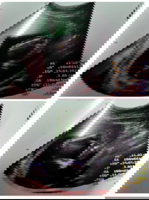 ลูกชายรึลูกสาวคะอยากให้แม่ๆช่วยฟันธงให้หน่อยคะ 😊😊😊