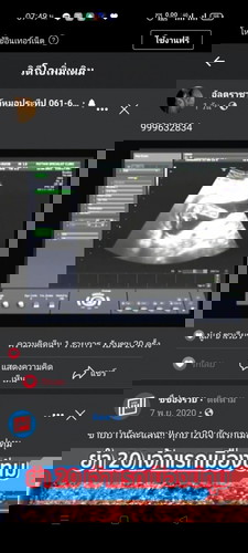 อยากรู้ว่าผู้หญิงรือชาย