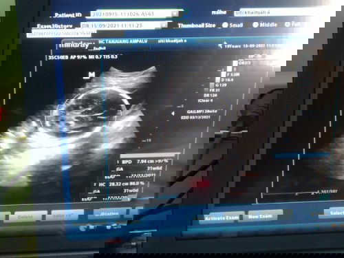 Yg bisa baca USG tolong dong,☺️