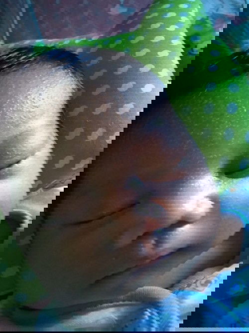 Di kepala kayak ada bekas luka